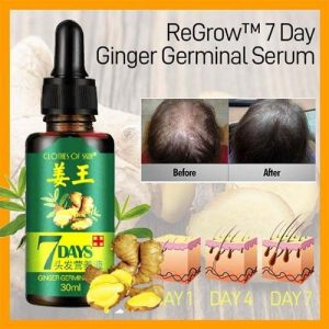 7-Day Ginger Hair Growth Oil