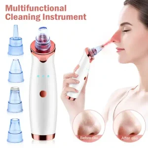blackhead remover 1