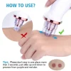 blackhead remover 3