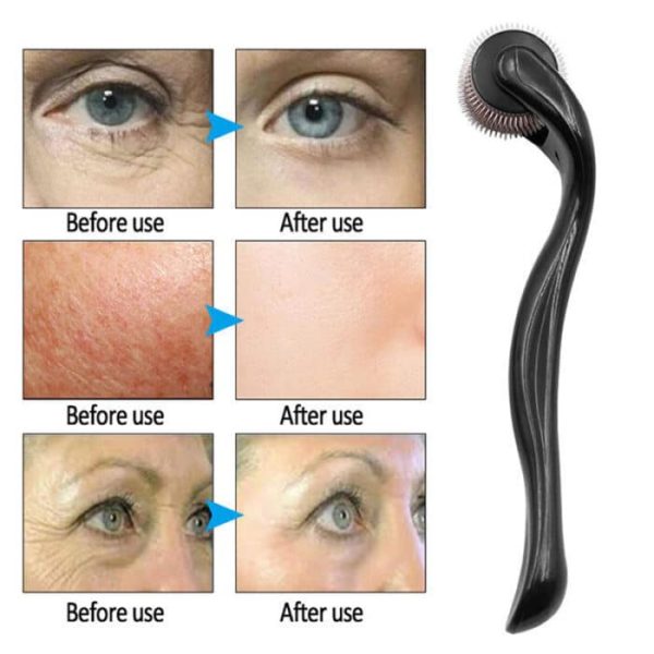 derma roller 4