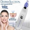 spot remover 1