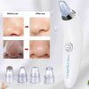 spot remover 2
